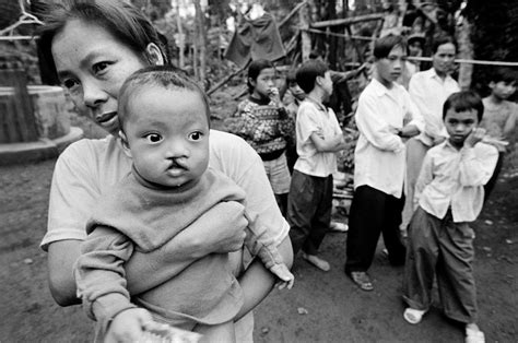 Agent Orange Collateral Damage In Vietnam Magnum Photos
