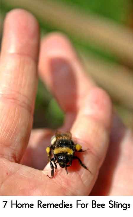 Wasps can sting multiple times and do not leave their sting behind in the skin. 7 Home Remedies For Bee Stings - Lil Moo Creations