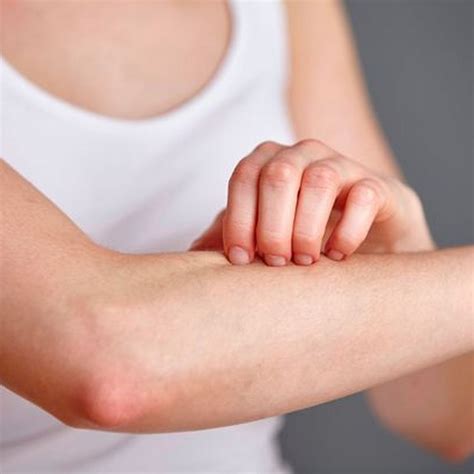 Itchy Forearms With Bumps Sale Websites Save 57 Jlcatjgobmx