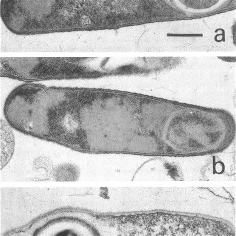 Electron Micrographs Of B Subtilis Db104 A And B And B Sphaericus