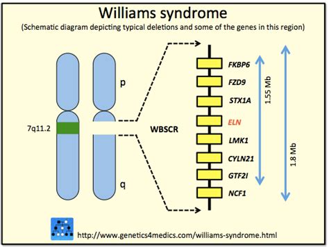 Williams Syndrome