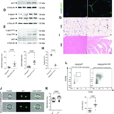 A Mouse Model Of Pik3ca Related Adipose Tissue Overgrowth A Male And