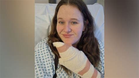 False Widow Spider Bite Victim Felt Finger Would Explode With Pain