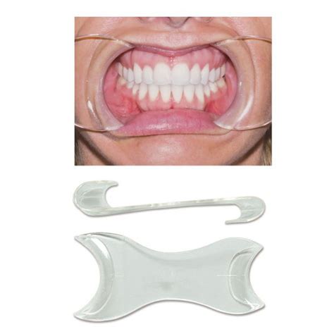 Orthodontic Cheek Retractors