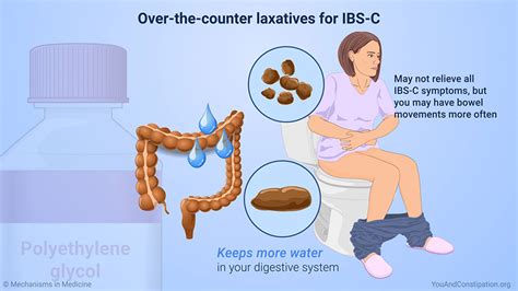 Slide Show Managing And Treating Ibs With Constipation