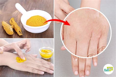 6 Highly Effective Ways To Use Turmeric For Eczema And Itching Fab How