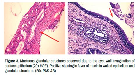 Oral Health Case Reports Glandular Structures