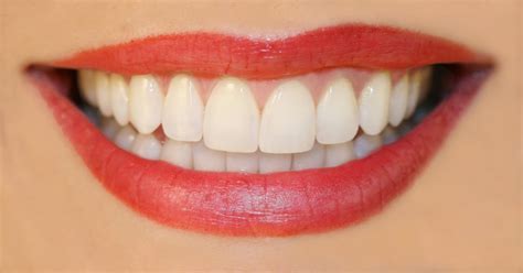 Bellevue Cosmetic Dentist Choosing The Best Dentistry Beautiful Smiles