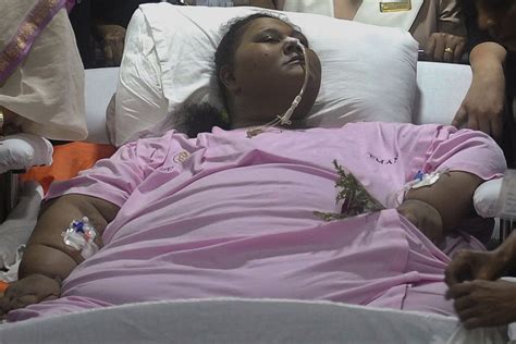 heaviest woman in the world facing health issues after weight loss surgery