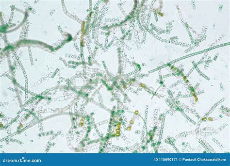 Filamentous Algae Are Single Algae Cells That Form Long Visible Stock