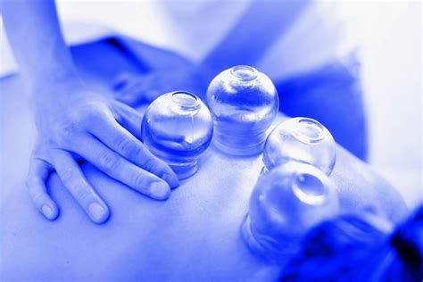 What Is Cupping Therapy How Does It Work Elysian Wellness