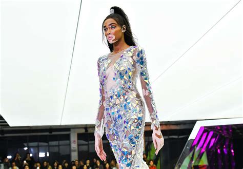 Winnie Harlow On Her Supermodel Fame My Plan Was To Never Fail