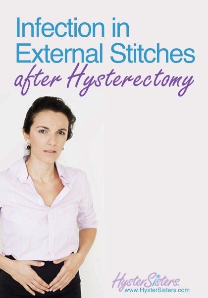 Is Your Hysterectomy Incision Burning Or Itching How Did You Treat