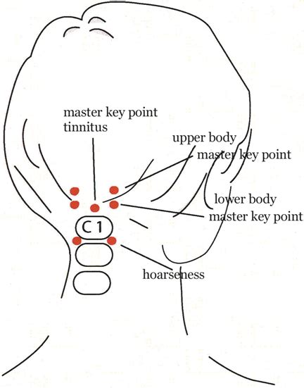 Master Key Points For Tinnitus Upper And Lower Body With Hoarseness