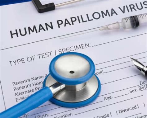 Article Human Papillomavirus Infection Prevention Measures Every