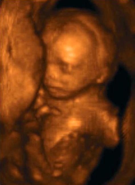 19 Weeks And 5 Days Pregnant Baby Fetal Progress Ultrasound