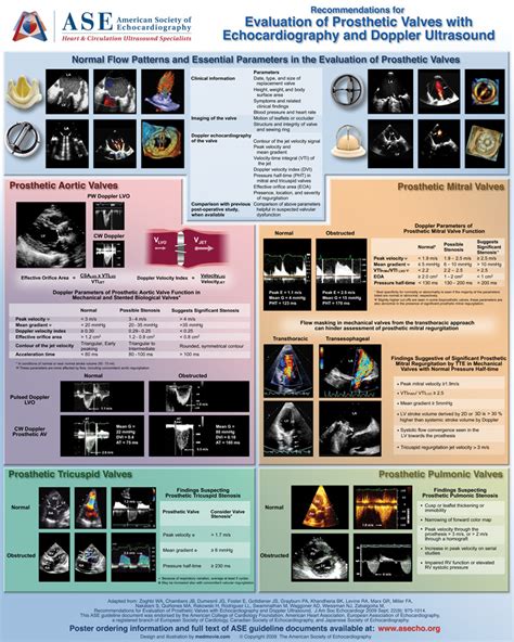 American Society Of Echocardiography Projects