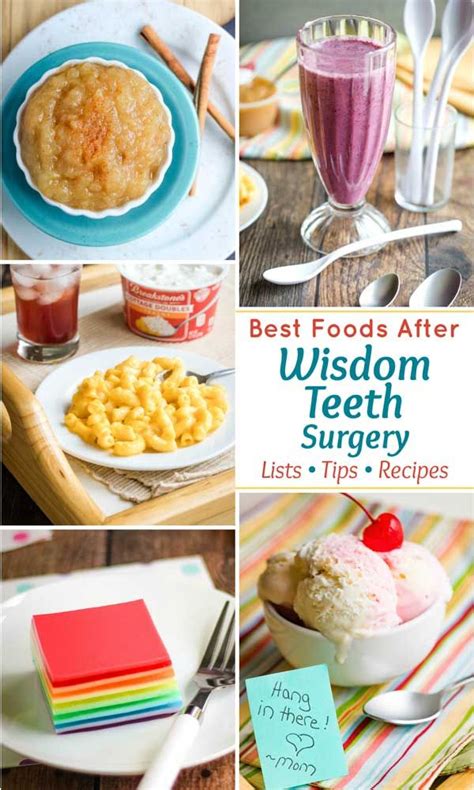Foods to avoid following dental surgery, implants or wisdom teeth extractions. Lists, Tips and Recipes! Lots of ideas for foods to help ...