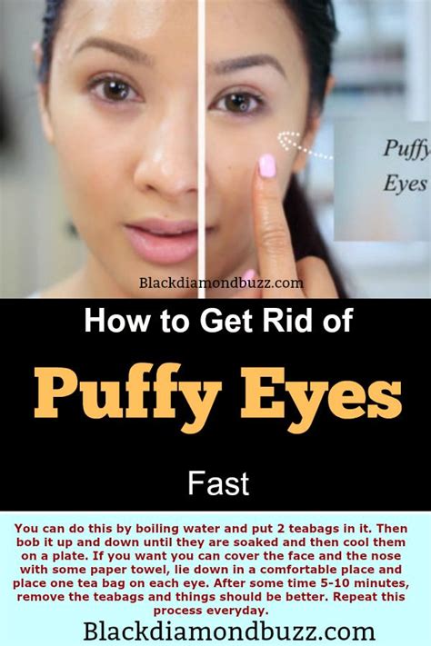 Pin On A Puffy Eyes