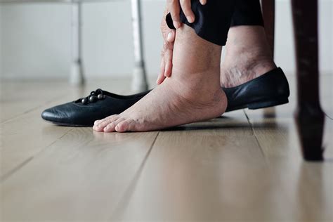 What Causes Swollen Feet In Elderly People Silverts
