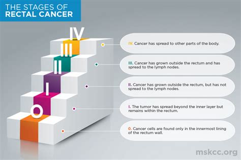 Stages Of Rectal Cancer Memorial Sloan Kettering Cancer Center