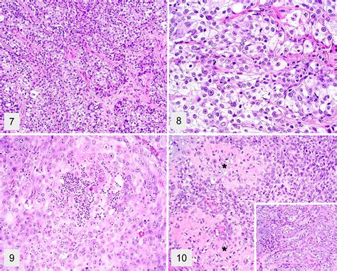 A Retrospective Study Of Salivary Gland Diseases In 179 Dogs 20102018
