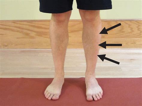 How To Prevent And Self Treat Shin Splints The Physical Therapy Advisor