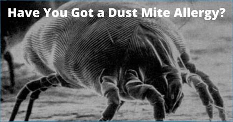 Have You Got A Dust Mite Allergy Complete Clean