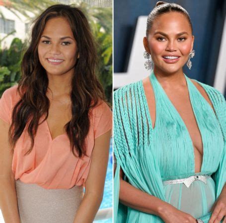 Everything To Know About Chrissy Teigen Plastic Surgery Here Before