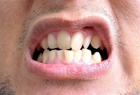 Nearly Of Us Worry About Our Mouths At Least Once A Day Dentistry