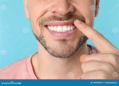 Smiling Man Showing Perfect Teeth On Color Background Stock Image