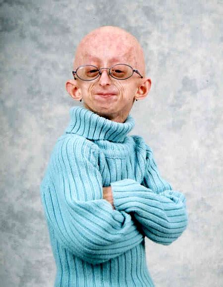 Progeria Syndrome Christine Odonnell