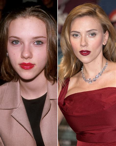 Scarlett Johansson Before And After Nose Job Ok Magazine