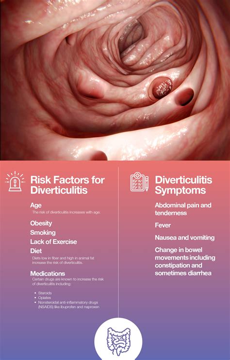 Diverticulosis And Diverticulitis Pictures