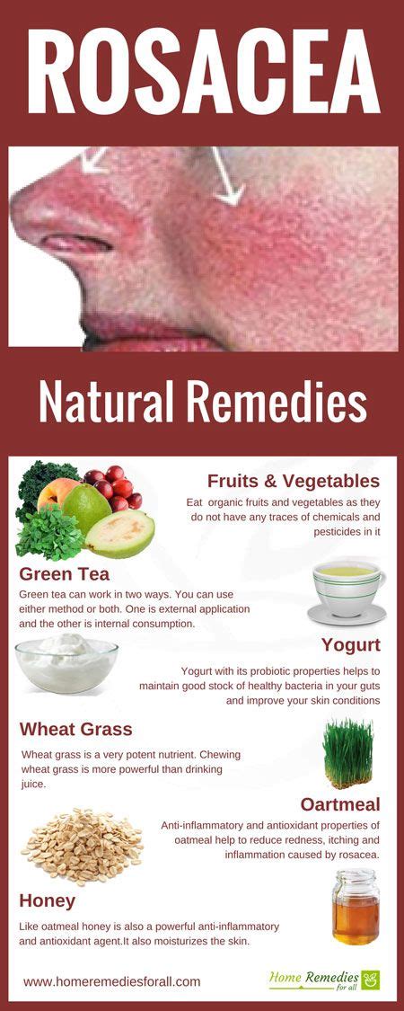 Rosacea Home Remedies Infographic Acne Remedies Homemade Natural