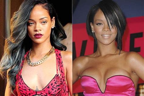 rihanna before and after plastic surgery 1313 celebrity plastic surgery online