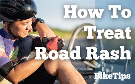 Taken A Tumble How To Treat Road Rash