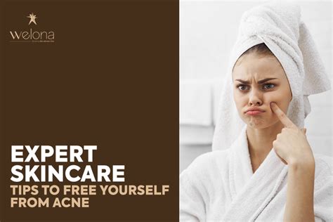 Expert Skincare Tips To Free Yourself From Acne Visit Welona