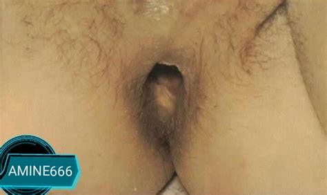 【閲覧注意】レ プされた若い女性の ”膣検査” の画像、無修正で流出してしまう ポッカキット