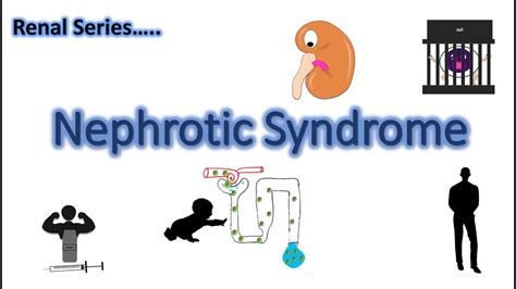 Nephrotic Syndrome Animation Pathophysiology Clinical Features