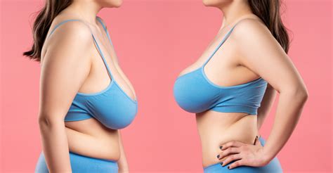 Is Breast Reduction Surgery Right For You Raleigh Plastic Surgery Center