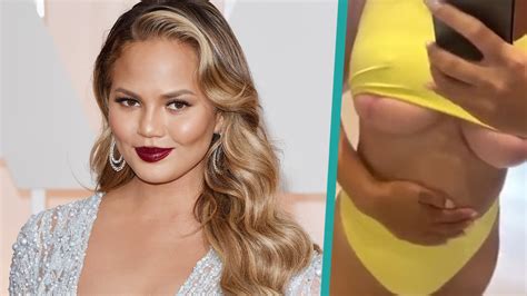 Watch Access Hollywood Interview Chrissy Teigen Proves She Had Breast Implants Removed By