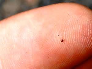 What Are Chiggers And How Do You Treat Chigger Bites Boys Life Magazine
