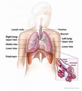 Lung Cancer in Non-Smokers - Directorate General of Health / Duhok Lung Cancer  