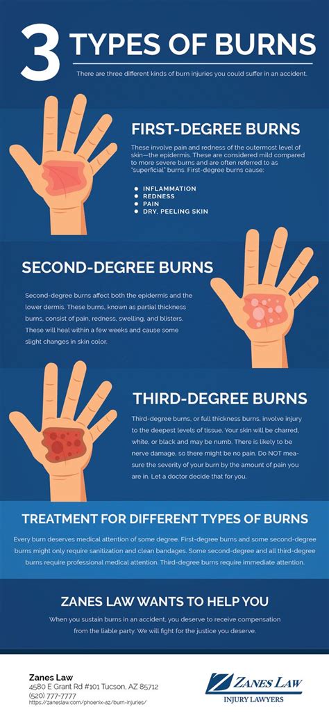 Different Types Of Burn Injuries