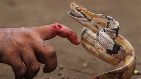 Is It Safe To Suck The Venom Out Of A Snake Bite