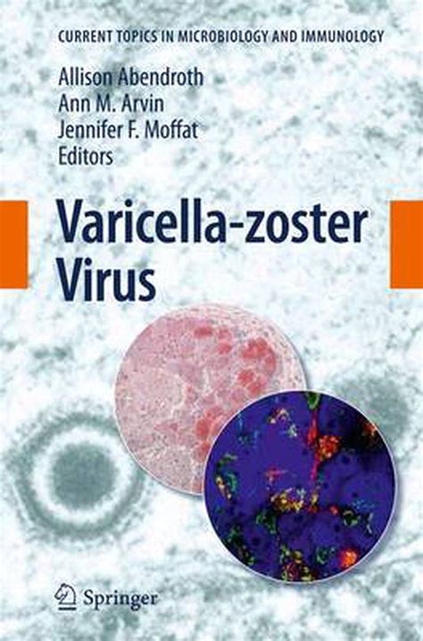 Varicella Zoster Virus English Paperback Book Free Shipping