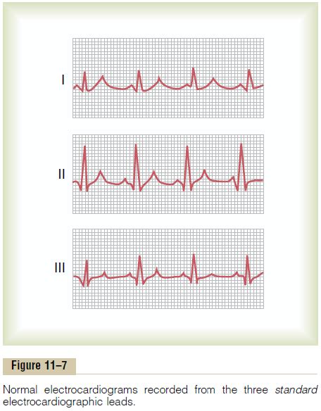 Electrocardiographic Leads Three Bipolar Limb Leads Chest Leads
