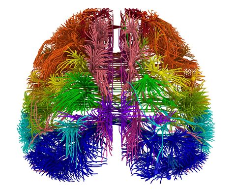 Researchers Report That They Have Created A Diagram Of A Mouses Brain