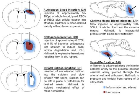 Schematic Depicts Models Commonly Used To Mimic Intracerebral